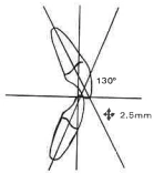 Manual Illustration